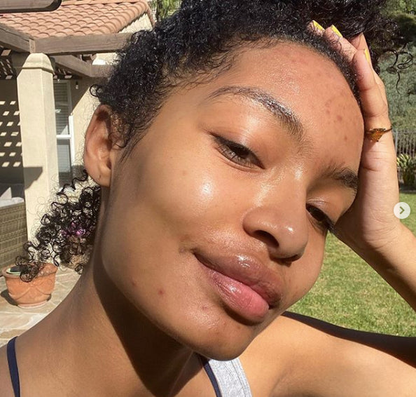 Article on The One Who Glows - Yara Shahidi in her Citrine Self Love Pinky Ring